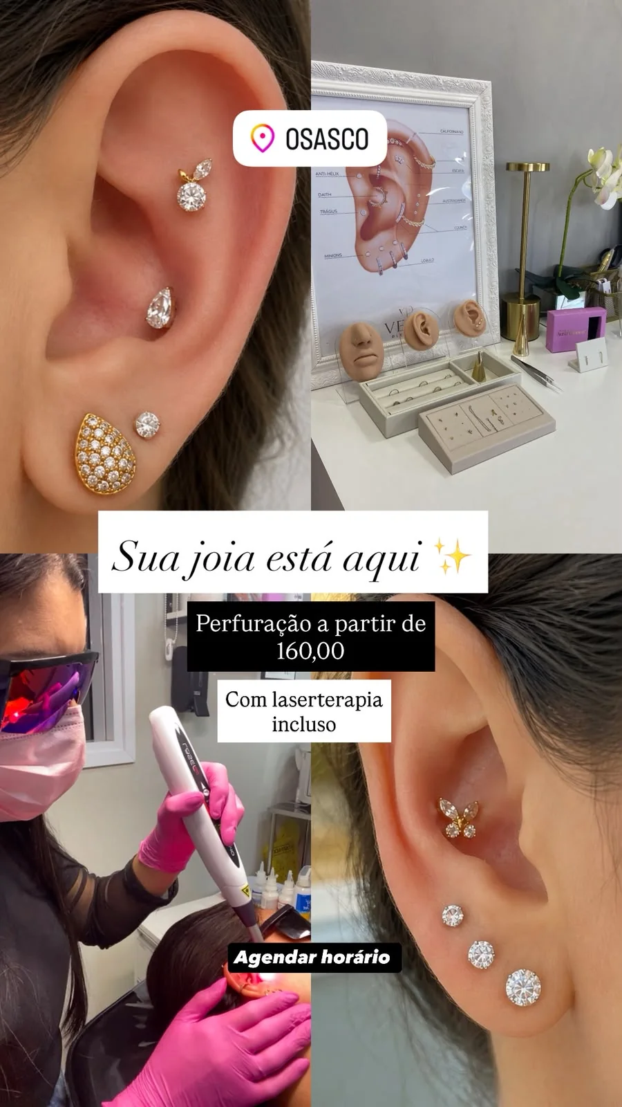Resultado real de piercing feito na Vega
